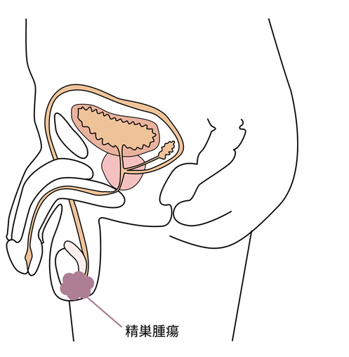 悪性腫瘍 北海道泌尿器科記念病院